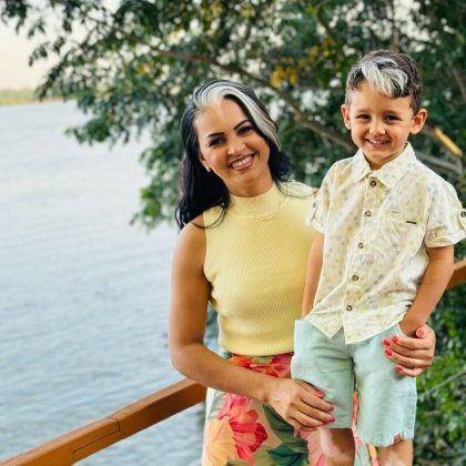 Histórias como essas ajudam a normalizar o piebaldismo e eliminar preconceitos, promovendo uma visão positiva da diversidade genética (Foto: Reprodução/Instagram/@fatima.theo.gomes)