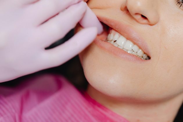 Mulher vai ao dentista para tratar dor no siso e descobre que tem apenas poucos meses de vida (Foto: Pexels)