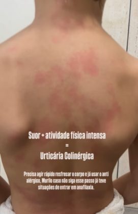 Sua mãe, Jhenifer Verônica, precisa controlar o tempo de atividade física do filho, pois ele não pode brincar por mais de 15 minutos sem risco de uma crise (Foto: Reprodução/Instagram/@jheniveronica)