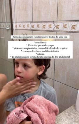 Jhenifer compartilhou um vídeo mostrando o rosto de Murilo durante uma crise de alergia, alertando sobre a condição rara (Foto: Reprodução/Instagram/@jheniveronica)