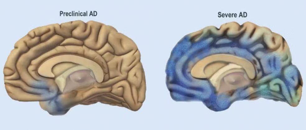 Cientistas analisaram os genes que tornam isso possível. Eles descobriram mudanças no hipotálamo e na sinalização de cálcio, que abrem canais diretos para o cérebro. Entre os genes estudados, alguns estão associados à obesidade e ao Alzheimer em humanos (Foto: Foto: National Institute on Aging, National Institutes of Health)