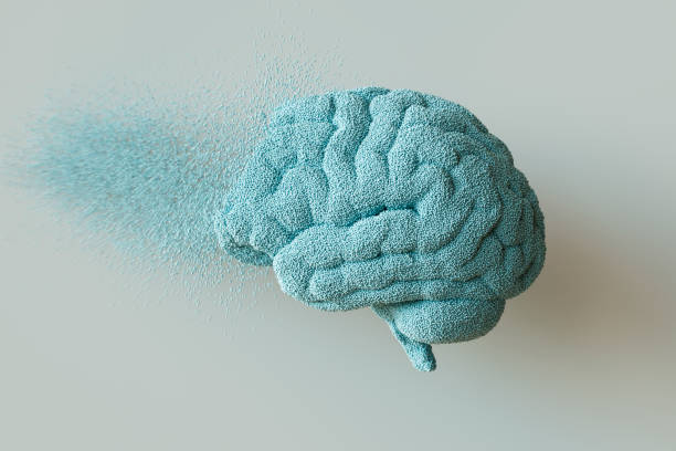 Uma pesquisa genômica revelou que pessoas que possuem grupos sanguíneos do tipo A são mais possibilitadas a terem um diangóstico de AVC (Acidente Vascular Cerebral) antes dos 60 anos em comparação com pessoas com outros tipos sanguíneos. (Foto: iStock)