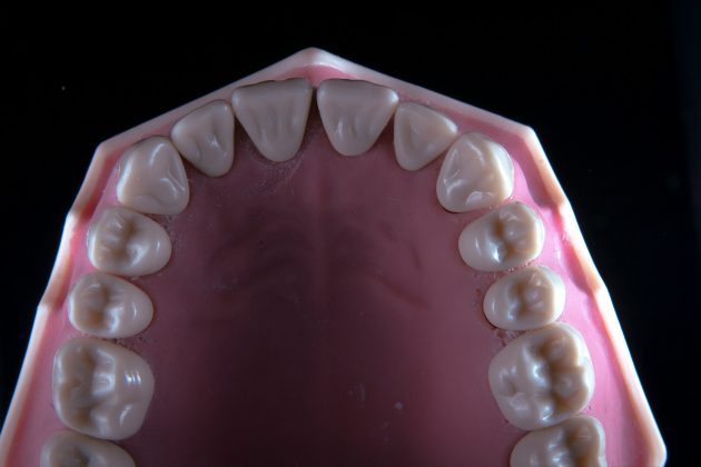 Atualmente, o ser humano passa por duas fases de dentição: os dentes de leite e os permanentes (Foto: Unsplash)