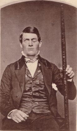 O intrigante caso do homem que sobreviveu a uma barra de ferro atravessando seu crânio, mas teve sua personalidade alterada (Foto: Wikimedia Commons)