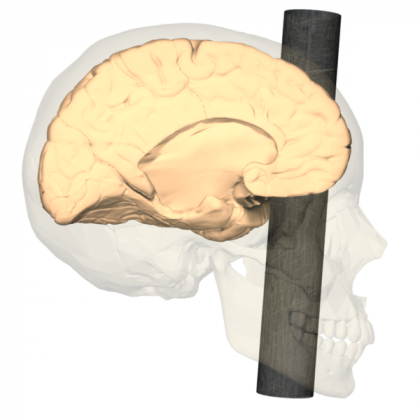 Phineas P. Gage sofreu um acidente em 1848, ao ter uma barra de ferro atravessando seu crânio. Surpreendentemente, ele sobreviveu e permaneceu consciente após o acidente (Foto: Polygon data is generated by Database Center for Life Science(DBCLS)[3]., CC BY-SA 2.1 JP, via Wikimedia Commons)