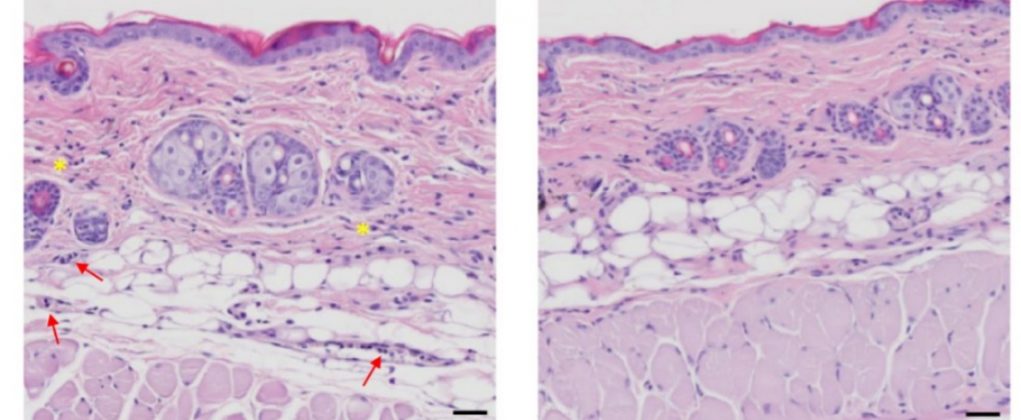 Esse dado muda o entendimento sobre os efeitos da radiação UV. Enquanto os danos ao DNA são permanentes, o RNA sofre agressões constantes e transitórias (Foto: Molecular Cell)