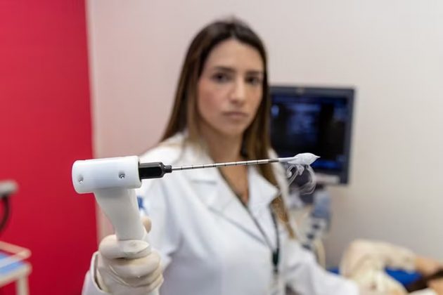 O procedimento utiliza nitrogênio líquido a cerca de -140°C. Por meio de uma agulha, o tumor é congelado e descongelado em ciclos. O método é minimamente invasivo, indolor e rápido. Pode ser feito com anestesia local, sem necessidade de internação (Foto: Divulgação/HSP/HU Unifesp)