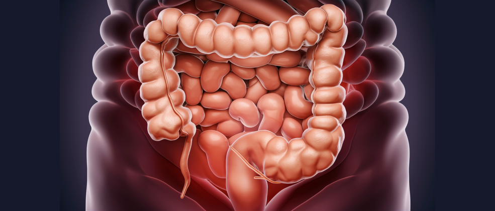 Estudos indicam que o TMF beneficia doenças inflamatórias intestinais, como colite ulcerativa e doença de Crohn, reduzindo inflamações e sintomas (Foto: Pixabay)