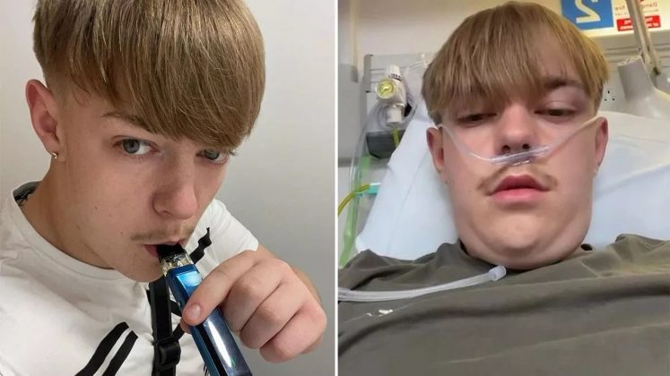 Jovem que usava vape há 5 anos fica apavorado após começar a tossir sangue (Foto: Reprodução/Mirror)