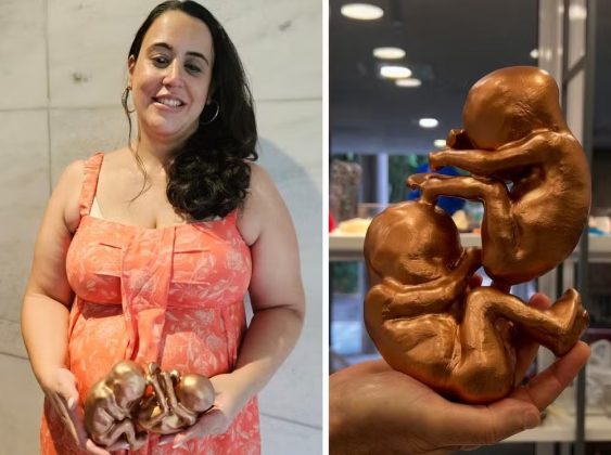 Recentemente, Maria teve a oportunidade de tocar uma reprodução em 3D dos bebês Fernando e Gabriela. Criado com tecnologia de impressão 3D, o modelo em tamanho real mostrou exatamente a posição e as características dos gêmeos, o que emocionou ainda mais a mãe (Foto: Reprodução/Crescer)