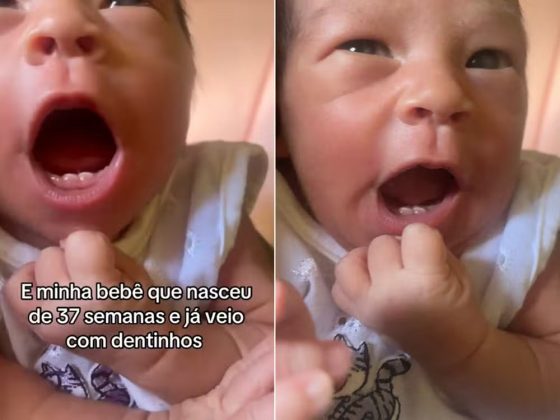 Bebê do Mato Grosso do Sul nasce com dois dentinhos e imagens viralizam nas redes sociais (Foto: Reprodução/TikTok)