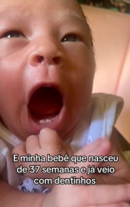 Ingrid também se surpreendeu ao ver a filha com dentes logo ao nascer. Mesmo assim, garantiu que Chloe passou por uma avaliação médica e não precisou retirar os dentinhos (Foto: Reprodução/TikTok)