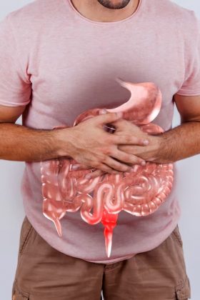 Homem sofre necrose intestinal após noiva eletrocutar sua barriga por 3 horas (Foto: Freepik)