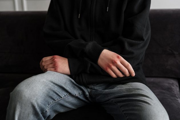 Os dados mostram que 81% dos jovens analisados passaram por algum tipo de trauma, como violência, abuso ou negligência. Quanto mais traumas diferentes uma pessoa enfrenta, maior o risco de desenvolver transtornos como ansiedade, depressão e problemas de conduta (Foto: Pexels)