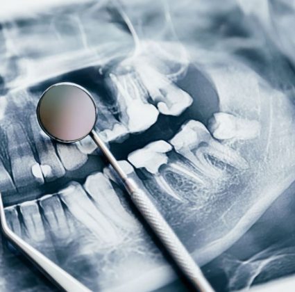 Pesquisadores japoneses estão explorando a regeneração de dentes humanos. (Imagem: reprodução instagram)