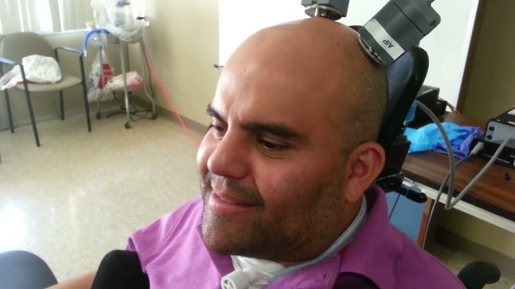 O sistema utiliza sensores implantados no cérebro para captar os sinais neurais emitidos quando o usuário imagina um movimento (Foto: X)