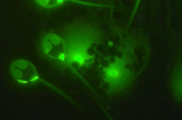 A ausência de necessidade de oxigênio em um animal multicelular sugere que formas de vida complexas podem existir em ambientes até hoje considerados hostis ou inabitáveis, como as profundezas dos oceanos ou até mesmo planetas sem atmosfera respirável (Foto: X)