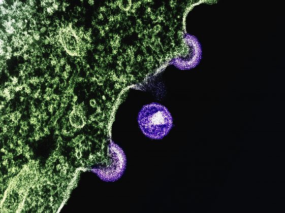 Essa alteração genética impede que o vírus use a proteína CCR5 — encontrada na superfície de certas células imunológicas — como porta de entrada (Foto: Unsplash)
