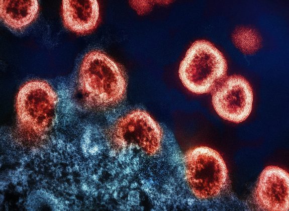 A mesma mutação já foi utilizada com sucesso em tratamentos experimentais que curaram pacientes com o vírus (Foto: Unsplash)